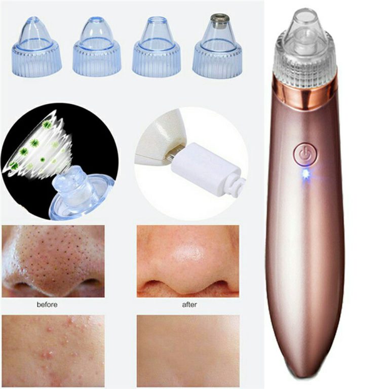4-in-1 Rechargeable Blackhead Remover – Vacuum Pore Cleaner & Skin Extractor