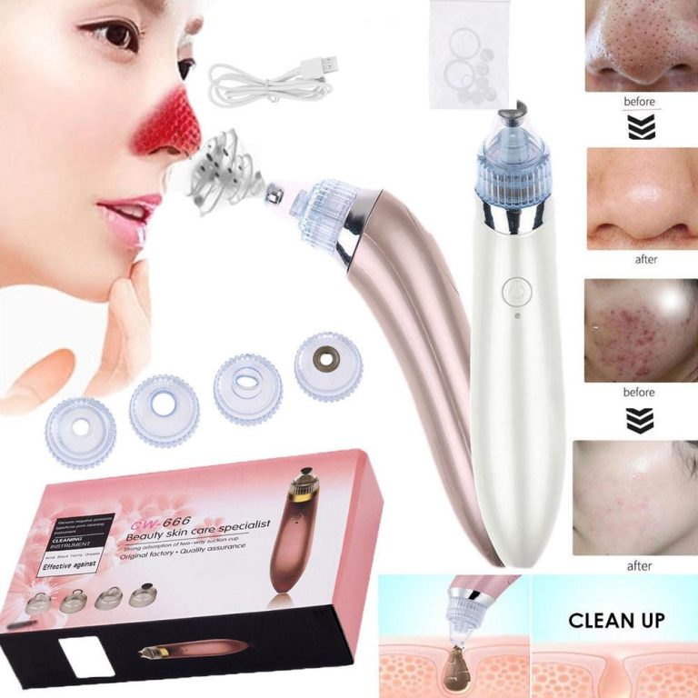 4-in-1 Rechargeable Blackhead Remover – Vacuum Pore Cleaner & Skin Extractor