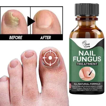 Applying nail repair gel for toenail fungus and damaged nails