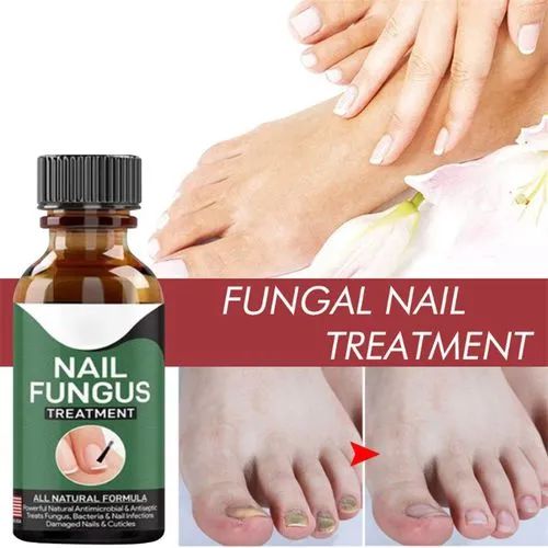 Before and after results of anti-fungal nail treatment serum